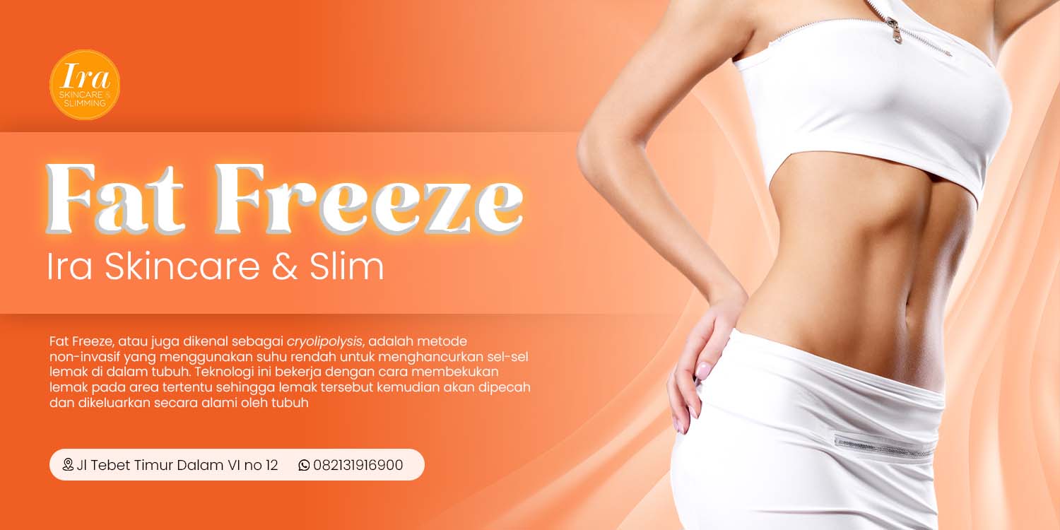Fat Freeze 02 Mei 2023