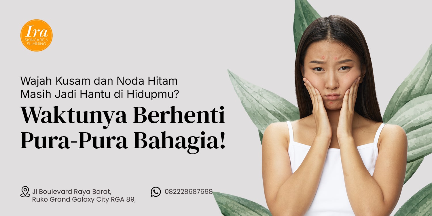 Thumbnail Bekasi Wajah Kusam dan Noda Hitam Masih Jadi Hantu di Hidupmu